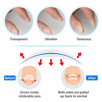 6Pc Uña Encarnada Fijador de Corrección de Dedo del Pie de Reparación de Cuidado de Uñas Pulsador Set de Pedicura de Uñas de la Herramienta