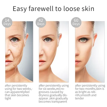 YOUNGBOOK la Reparación de Crema para la Cara que se Desvanece el Acné Marca Iluminador Facial Crema Blanqueadora Hidratante Anti-Envejecimiento de Cuidado de la Piel 25g