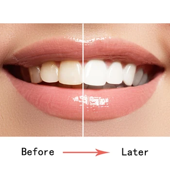 Compatible con Philips Sonicare Cepillo de Cabezas del Reemplazo del Cepillo de dientes Cabezas de Ajuste Diamondclean ProtectiveClean Salud de las Encías FlexCare