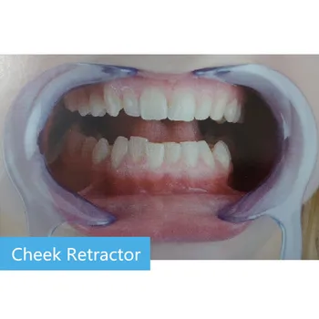 10pcs/set Retractor de la Mejilla Blanquear los Dientes de Forma C Dental Retractores Intraoral Labio de la Boca Abridor Blanchiment Dentaire