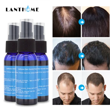 Lanthome Contra la Pérdida del Cabello Producto Tónico en Spray para el Crecimiento del Cabello Alopecia Contra la Calvicie Tratamiento Sunburst de Rebrote de Cabello Líquido Yuda
