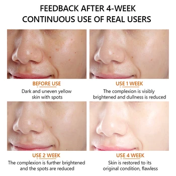 VIBRANTE GLAMOUR de la Vitamina C en Suero facial Hidratante Blanqueamiento Iluminar Anti-Envejecimiento, Anti-Arrugas Desvanece Líneas de expresión Facial Cuidado de la Piel