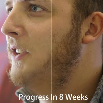 Crecimiento de la barba de Aceite de Suero Activador de Bálsamo para los Parches Faciales de Rebrote de Cabello y Grosor Regalo Perfecto para los Hombres con Barba Orgánico